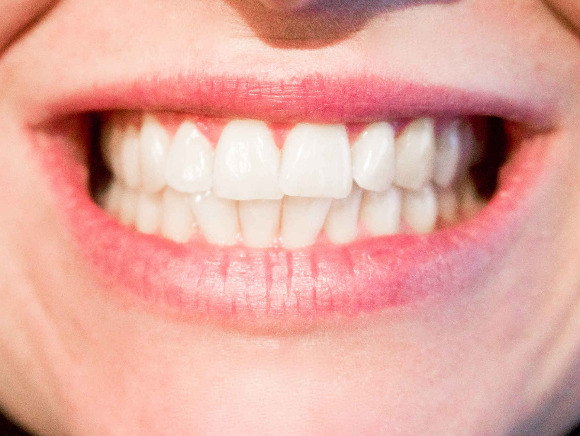 teeth-1652976_1920